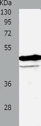 Vascular Endothelial Growth Factor C antibody, TA321716, Origene, Western Blot image 