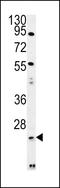Lysophospholipase Like 1 antibody, LS-C163939, Lifespan Biosciences, Western Blot image 