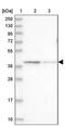 Leucine Rich Repeat Containing 31 antibody, PA5-57998, Invitrogen Antibodies, Western Blot image 