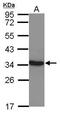 Lactate Dehydrogenase C antibody, PA5-30079, Invitrogen Antibodies, Western Blot image 