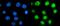 Proteasome 26S Subunit, ATPase 3 antibody, M07208-2, Boster Biological Technology, Immunofluorescence image 