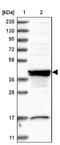 Sorting Nexin 31 antibody, NBP1-92423, Novus Biologicals, Western Blot image 