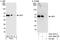 Latent membrane protein 1 antibody, A301-958A, Bethyl Labs, Immunoprecipitation image 