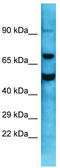 G Protein Nucleolar 1 (Putative) antibody, TA335087, Origene, Western Blot image 