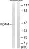 Protein Mdm4 antibody, LS-C199242, Lifespan Biosciences, Western Blot image 