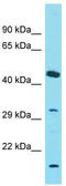 Olfactory Receptor Family 4 Subfamily C Member 6 antibody, TA334811, Origene, Western Blot image 