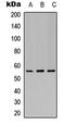 Potassium Voltage-Gated Channel Subfamily J Member 3 antibody, LS-C368387, Lifespan Biosciences, Western Blot image 