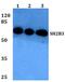 SH2B adapter protein 3 antibody, PA5-75638, Invitrogen Antibodies, Western Blot image 