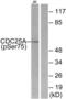 Cell Division Cycle 25A antibody, LS-C117315, Lifespan Biosciences, Western Blot image 