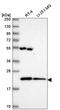Mitochondrial Ribosomal Protein L47 antibody, HPA047779, Atlas Antibodies, Western Blot image 