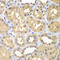 Ketohexokinase antibody, 22-940, ProSci, Immunohistochemistry paraffin image 