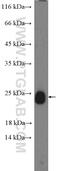 Ras-related protein Rab-34 antibody, 13355-1-AP, Proteintech Group, Western Blot image 
