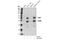 FosB Proto-Oncogene, AP-1 Transcription Factor Subunit antibody, 2263S, Cell Signaling Technology, Western Blot image 