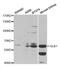 Galactosidase Beta 1 antibody, TA332449, Origene, Western Blot image 
