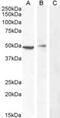 TBC1 Domain Family Member 10C antibody, NBP2-76349, Novus Biologicals, Western Blot image 