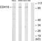 Cadherin-18 antibody, TA313604, Origene, Western Blot image 