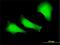 FA Complementation Group C antibody, H00002176-M01, Novus Biologicals, Immunocytochemistry image 