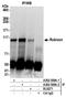 Run domain Beclin-1 interacting and cystein-rich containing protein antibody, A302-569A, Bethyl Labs, Immunoprecipitation image 