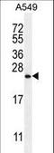 Sorting Nexin 24 antibody, LS-C161369, Lifespan Biosciences, Western Blot image 