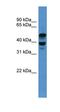 Activating Signal Cointegrator 1 Complex Subunit 1 antibody, orb330893, Biorbyt, Western Blot image 