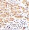 Interferon regulatory factor 5 antibody, FNab10757, FineTest, Immunohistochemistry paraffin image 