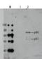 HIV1 gp41 antibody, 65-002, BioAcademia Inc, Western Blot image 