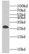 Eukaryotic Translation Initiation Factor 4H antibody, FNab02726, FineTest, Western Blot image 