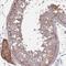 Zinc Finger FYVE-Type Containing 28 antibody, HPA057587, Atlas Antibodies, Immunohistochemistry paraffin image 