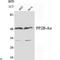 Serine/threonine-protein phosphatase 2B catalytic subunit alpha isoform antibody, LS-C814111, Lifespan Biosciences, Western Blot image 