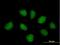 E3 ubiquitin-protein ligase RNF220 antibody, H00055182-B01P, Novus Biologicals, Immunocytochemistry image 