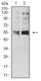 5-Hydroxytryptamine Receptor 3B antibody, NBP2-61792, Novus Biologicals, Western Blot image 