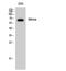 Protein enabled homolog antibody, A05337, Boster Biological Technology, Western Blot image 