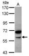 Amylase Alpha 2B (Pancreatic) antibody, NBP2-19687, Novus Biologicals, Western Blot image 