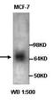 DNA-(apurinic or apyrimidinic site) lyase 2 antibody, orb77105, Biorbyt, Western Blot image 