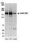 UHRF1 Binding Protein 1 antibody, A304-646A, Bethyl Labs, Western Blot image 
