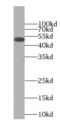 Peroxisome Proliferator Activated Receptor Delta antibody, FNab06665, FineTest, Western Blot image 