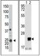 ADP Ribosylation Factor Like GTPase 3 antibody, AP12135PU-N, Origene, Western Blot image 