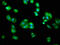 Alanine--glyoxylate aminotransferase 2, mitochondrial antibody, CSB-PA866322LA01HU, Cusabio, Immunofluorescence image 