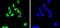 Structural Maintenance Of Chromosomes 1A antibody, A02148-4, Boster Biological Technology, Immunocytochemistry image 