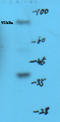 3-Hydroxy-3-Methylglutaryl-CoA Reductase antibody, orb6191, Biorbyt, Western Blot image 