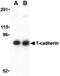MON1 Homolog B, Secretory Trafficking Associated antibody, A10606, Boster Biological Technology, Western Blot image 