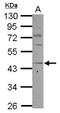 C-C chemokine receptor type 8 antibody, NBP2-15767, Novus Biologicals, Western Blot image 