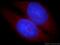 WASL antibody, 14306-1-AP, Proteintech Group, Immunofluorescence image 