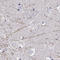 Doublecortin Like Kinase 3 antibody, HPA040685, Atlas Antibodies, Immunohistochemistry paraffin image 