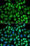 Mitogen-activated protein kinase 3 antibody, LS-C748395, Lifespan Biosciences, Immunofluorescence image 