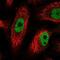PHD finger protein 12 antibody, NBP2-58148, Novus Biologicals, Immunofluorescence image 