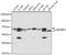 Insulin Like Growth Factor 2 MRNA Binding Protein 1 antibody, 15-085, ProSci, Western Blot image 