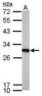 Phosphoglycerate Mutase 1 antibody, TA308373, Origene, Western Blot image 