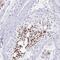 Zinc finger protein Rlf antibody, PA5-63430, Invitrogen Antibodies, Immunohistochemistry frozen image 