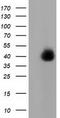 LRAT Domain Containing 2 antibody, CF501968, Origene, Western Blot image 